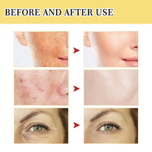 Load image into Gallery viewer, Anti-aging Fade Fine Lines Repairing Essence Serum
